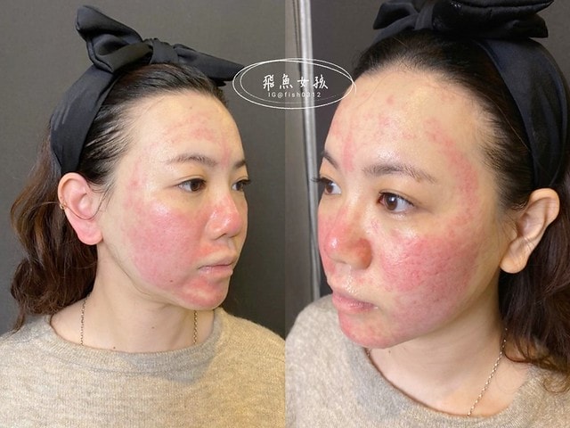 賦真妍,賦真妍整形外科醫美診所,水潤極光養膚計畫,白賦美肌密,BBL青春光耀,賦真妍皮膚專科診所,賦真妍評價,白賦美肌密評價,BBL青春光耀評價,BBL青春光耀有用嗎,BBL青春光耀ppt,BBL青春光耀是什麼,忠孝敦化醫美推薦,台北醫美推薦,台北東區醫美,青春光耀bbl價格,青春光耀bbl,賦真妍皮秒,飛魚女孩,跟著飛魚變美麗,賦真妍凝時黑松露燕窩修護凍膜