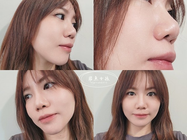 賦真妍,賦真妍整形外科醫美診所,水潤極光養膚計畫,白賦美肌密,BBL青春光耀,賦真妍皮膚專科診所,賦真妍評價,白賦美肌密評價,BBL青春光耀評價,BBL青春光耀有用嗎,BBL青春光耀ppt,BBL青春光耀是什麼,忠孝敦化醫美推薦,台北醫美推薦,台北東區醫美,青春光耀bbl價格,青春光耀bbl,賦真妍皮秒,飛魚女孩,跟著飛魚變美麗,賦真妍凝時黑松露燕窩修護凍膜