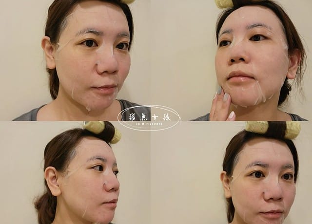 名悅時尚診所 Dcard,名悅時尚診所評價,名悅時尚診所 價格,名 悅 皮秒,名悅時尚診所,皮秒雷射術後保養品推薦,皮秒雙機亮白雷射,皮秒結痂ptt,皮秒雷射心得,皮秒止癢,皮秒術後保養品推薦,皮秒雷射推薦台北,皮秒推薦,皮秒蜂巢,皮秒蜂巢術後癢,皮秒蜂巢術後保養品推薦,皮秒蜂巢多久打一次,皮秒蜂巢毛孔dcard,蜂巢皮秒毛孔ptt,皮秒蜂巢 恢復期 PTT,皮秒雷射效果,名悅時尚,皮秒雙機雷射推薦,打擊痘疤曬斑,皮秒雷射後遺症,皮秒雷射療程步驟,如何改善肌膚瑕疵,混和肌瑕疵修復,皮秒雷射真實記錄 名悅時尚診所 Dcard,名悅時尚診所評價,名悅時尚診所 價格,名 悅 皮秒,名悅時尚診所,皮秒雷射術後保養品推薦,皮秒雙機亮白雷射,皮秒結痂ptt,皮秒雷射心得,皮秒止癢,皮秒術後保養品推薦,皮秒雷射推薦台北,皮秒推薦,皮秒蜂巢,皮秒蜂巢術後癢,皮秒蜂巢術後保養品推薦,皮秒蜂巢多久打一次,皮秒蜂巢毛孔dcard,蜂巢皮秒毛孔ptt,皮秒蜂巢 恢復期 PTT,皮秒雷射效果,名悅時尚,皮秒雙機雷射推薦,打擊痘疤曬斑,皮秒雷射後遺症,皮秒雷射療程步驟,如何改善肌膚瑕疵,混和肌瑕疵修復,皮秒雷射真實記錄