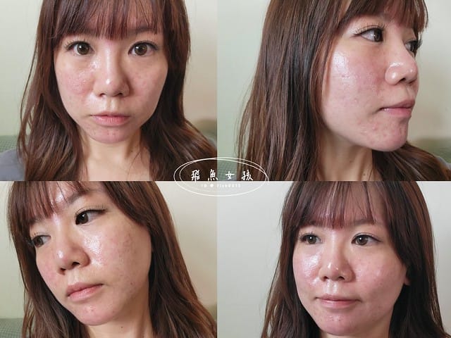 DF美肌醫生,植萃奇蹟修護精華油,植萃奇蹟修護水精華,植萃修護唇油,水光瓶,小紅油,df美肌醫生好用嗎,df美肌醫生評價,df美肌醫生ptt,df美肌醫生dcard,df美肌醫生屈臣氏,df美肌醫生康是美,台塑 生 醫 保養品 PTT,台塑生醫保養品評價,forte保養品ptt,李美青醫生,長庚李美青評價,df美肌醫生防曬,apivita小紅油dcard,韓國水光安瓶,無添加保養,秒吸收,零油光,強化肌膚防護力,高滲透,適合所有膚質,無痛水光,水光瓶,一滴輕盈,輕透,爆水感,年度最佳精華液,油保養,強化肌膚防護力,一滴逆齡,小紅油,從頭到腳照顧肌膚,秒吸收零油光,醫學美容後最佳修護,低溫淬煉保存活性,非凡士林,5大植物及維他命E,一抹豐潤,嘟嘟唇,唇膏打底,秒軟化硬皮,擺脫乾裂唇 DF美肌醫生,植萃奇蹟修護精華油,植萃奇蹟修護水精華,植萃修護唇油,水光瓶,小紅油,df美肌醫生好用嗎,df美肌醫生評價,df美肌醫生ptt,df美肌醫生dcard,df美肌醫生屈臣氏,df美肌醫生康是美,台塑 生 醫 保養品 PTT,台塑生醫保養品評價,forte保養品ptt,李美青醫生,長庚李美青評價,df美肌醫生防曬,apivita小紅油dcard,韓國水光安瓶,無添加保養,秒吸收,零油光,強化肌膚防護力,高滲透,適合所有膚質,無痛水光,水光瓶,一滴輕盈,輕透,爆水感,年度最佳精華液,油保養,強化肌膚防護力,一滴逆齡,小紅油,從頭到腳照顧肌膚,秒吸收零油光,醫學美容後最佳修護,低溫淬煉保存活性,非凡士林,5大植物及維他命E,一抹豐潤,嘟嘟唇,唇膏打底,秒軟化硬皮,擺脫乾裂唇