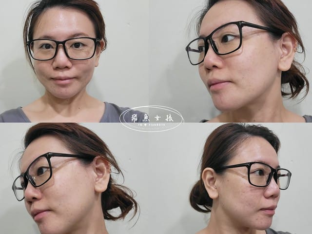 DF美肌醫生,植萃奇蹟修護精華油,植萃奇蹟修護水精華,植萃修護唇油,水光瓶,小紅油,df美肌醫生好用嗎,df美肌醫生評價,df美肌醫生ptt,df美肌醫生dcard,df美肌醫生屈臣氏,df美肌醫生康是美,台塑 生 醫 保養品 PTT,台塑生醫保養品評價,forte保養品ptt,李美青醫生,長庚李美青評價,df美肌醫生防曬,apivita小紅油dcard,韓國水光安瓶,無添加保養,秒吸收,零油光,強化肌膚防護力,高滲透,適合所有膚質,無痛水光,水光瓶,一滴輕盈,輕透,爆水感,年度最佳精華液,油保養,強化肌膚防護力,一滴逆齡,小紅油,從頭到腳照顧肌膚,秒吸收零油光,醫學美容後最佳修護,低溫淬煉保存活性,非凡士林,5大植物及維他命E,一抹豐潤,嘟嘟唇,唇膏打底,秒軟化硬皮,擺脫乾裂唇 DF美肌醫生,植萃奇蹟修護精華油,植萃奇蹟修護水精華,植萃修護唇油,水光瓶,小紅油,df美肌醫生好用嗎,df美肌醫生評價,df美肌醫生ptt,df美肌醫生dcard,df美肌醫生屈臣氏,df美肌醫生康是美,台塑 生 醫 保養品 PTT,台塑生醫保養品評價,forte保養品ptt,李美青醫生,長庚李美青評價,df美肌醫生防曬,apivita小紅油dcard,韓國水光安瓶,無添加保養,秒吸收,零油光,強化肌膚防護力,高滲透,適合所有膚質,無痛水光,水光瓶,一滴輕盈,輕透,爆水感,年度最佳精華液,油保養,強化肌膚防護力,一滴逆齡,小紅油,從頭到腳照顧肌膚,秒吸收零油光,醫學美容後最佳修護,低溫淬煉保存活性,非凡士林,5大植物及維他命E,一抹豐潤,嘟嘟唇,唇膏打底,秒軟化硬皮,擺脫乾裂唇