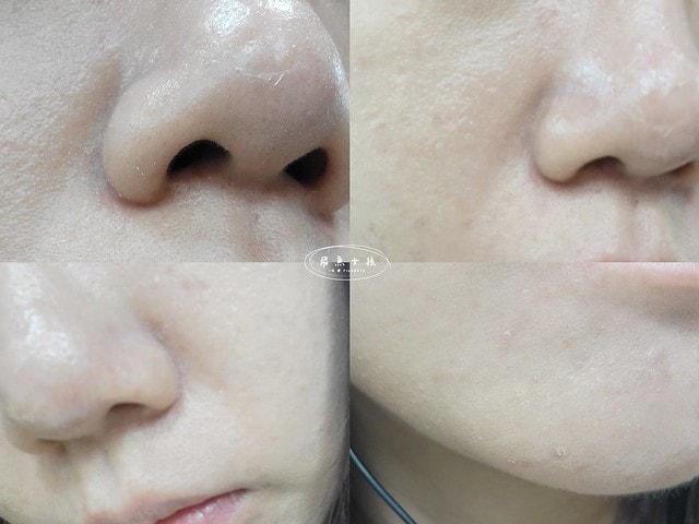 賦真妍,賦真妍皮膚專科診所,JETPEEL,潔比爾,開啟原生肌膚之旅,醫療級肌膚保養新概念,無微不至的量身美學,賦真妍dcard,賦真妍ptt,潔比爾是什麼,潔比爾價錢,潔比爾dcard,潔比爾價格dcard,潔比爾ptt,潔比爾功效,潔比爾認證診所,潔比爾台北,潔比爾頭皮dcard,潔比爾保養體驗,跟著飛魚變美麗,潔比爾ptt,潔比爾海菲秀,醫美保濕療程,醫美保濕導入ptt,醫美保養dcard,jetpeel費用,jet peel價錢ptt,jetpeel 價格,jetpeel 台北