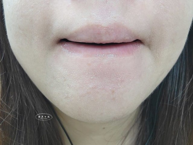 Green Cynia評價,植萃面膜開箱,漢方保濕面膜評價,草本植萃面膜推薦,平價保濕面膜心得,百元內植萃面膜,團購熱銷面膜開箱,熬夜修護急救面膜,全效面膜開箱,醫美後保濕面膜推薦,百元舒緩面膜推薦,角鯊烷面膜心得,積雪草舒緩面膜開箱,平價保濕面膜推薦,平價面膜推薦dcard,平價保濕面膜推薦dcard,平價面膜推薦ptt,醫美術後面膜dcard,醫美術後面膜推薦,皮秒術後面膜dcard,換季肌膚急救,換季皮膚不穩定,換季長痘痘dcard,換季脫皮dcard,臉脫皮急救dcard