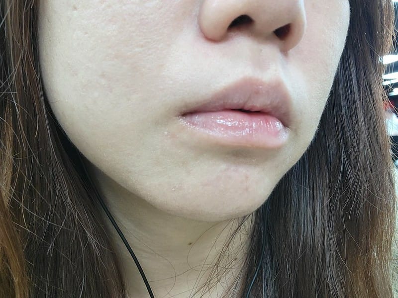 Ido船井醫朵,醫朵Ido黑玫瑰抗老修護系列,媽媽界撫紋神器,黑玫瑰抗老修護系列,黑玫瑰抗老修護系列評價,雙波類肉毒胜肽,貴婦級普拉斯鏈,黑玫瑰抗老緊膚金萃,黑玫瑰抗老膠原乳霜,船井美體霜dcard,船井生醫評價,船井生醫評價ptt,船井生醫ptt,船井生醫有效嗎,船井生醫dcard,黑繃帶修護乳霜dcard,黑繃帶白繃帶dcard,黑繃帶乳霜ptt,黑繃帶使用方法ptt,緊緻繃帶霜 Ido船井醫朵,醫朵Ido黑玫瑰抗老修護系列,媽媽界撫紋神器,黑玫瑰抗老修護系列,黑玫瑰抗老修護系列評價,雙波類肉毒胜肽,貴婦級普拉斯鏈,黑玫瑰抗老緊膚金萃,黑玫瑰抗老膠原乳霜,船井美體霜dcard,船井生醫評價,船井生醫評價ptt,船井生醫ptt,船井生醫有效嗎,船井生醫dcard,黑繃帶修護乳霜dcard,黑繃帶白繃帶dcard,黑繃帶乳霜ptt,黑繃帶使用方法ptt,緊緻繃帶霜