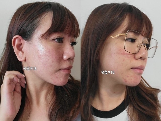 歐瑞生醫評價,歐瑞生醫膠原蛋白評價,歐瑞生醫膠原蛋白推薦嗎,強健豐盈法絲膠原蛋白實測心得,傷口癒合維他命C水解膠原蛋白有感分享,膠原蛋白粉開箱,無腥味膠原蛋白分享,養顏美容必備膠原蛋白分享,高含量膠原蛋白推薦,課程後營養補給好物分享,高含量膠原蛋白心得,青春美麗好物分享,養顏美容最佳夥伴,醫美推薦膠原蛋白開箱,歐瑞生醫膠原蛋白dcard,歐瑞生醫膠原蛋白ptt,歐瑞生醫膠原蛋白有效嗎,allre 強健 豐盈 法 絲 膠原 蛋白 評價,allre 膠原 蛋白 dcard,allre 膠原 蛋白 有效 嗎